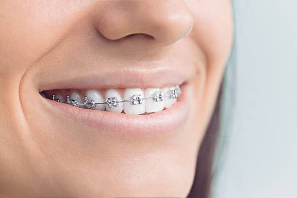 Best Invisalign and Clear Aligners  in Randolph Af, TX